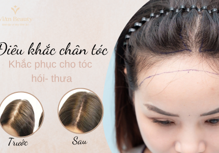 Điêu khắc sợi tóc – giải pháp cho người tóc yếu