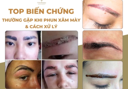 Top Biến Chứng Thường Gặp Khi Phun Xăm Mày & Cách Xử Lý