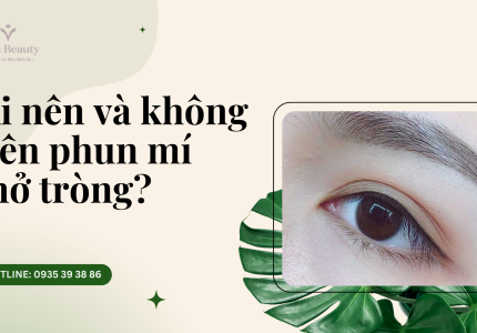 Ai nên và không nên phun mí mở tròng?
