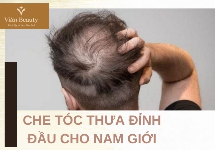 Che tóc thưa đỉnh đầu cho nam giới bằng điêu khắc tóc