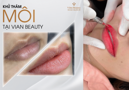 Khử Thâm Môi Có Đau Không? Bao Lâu Lên Màu?