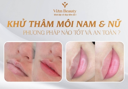 Khử Thâm Môi Cho Nam & Nữ: Phương Pháp Nào Tốt Và An Toàn?