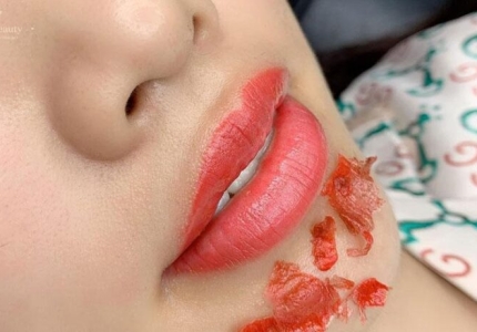 Phun Môi Bao Lâu Thì Bong? Có Cần Dặm Lại Không?