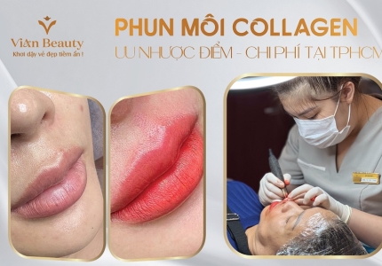 Có Nên Làm Phun Môi Collagen? Ưu Nhược Điểm và Chi Phí Tại TPHCM