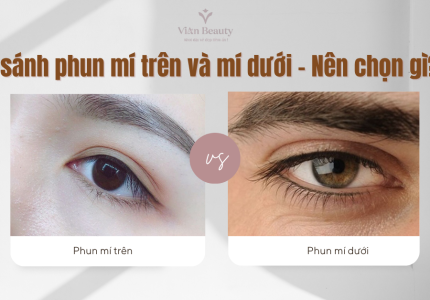 So sánh phun mí trên và mí dưới – Nên chọn gì?