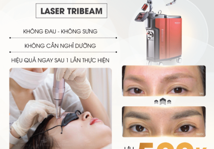 Ưu Đãi Tháng 6/2025 – Chăm Sóc Da & Xóa Thâm Hiệu Quả Tại Vian Beauty