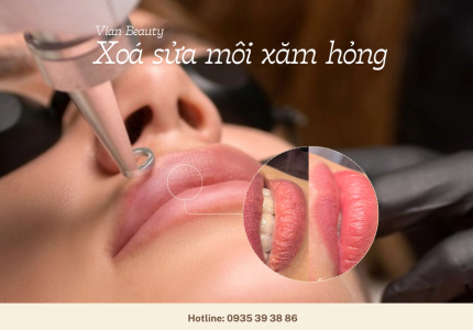 Xóa sửa môi cũ – Trả lại nền môi tự nhiên