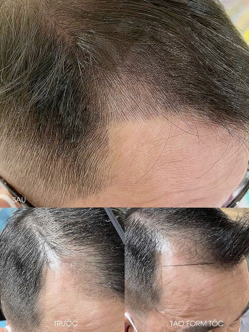 Anh Thuc Te Khach Hang Dieu Khac Toc 4