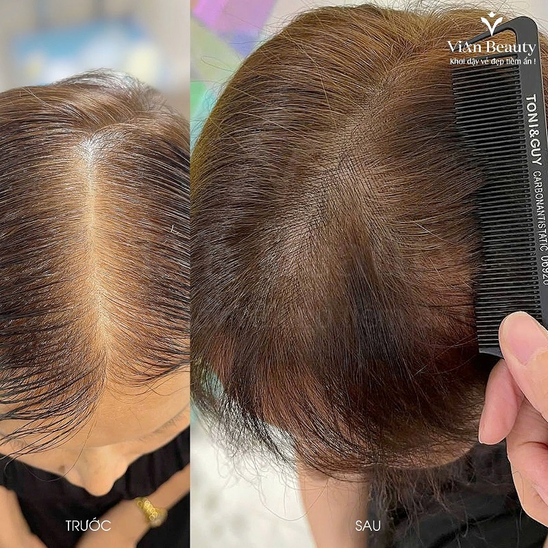 Anh Thuc Te Khach Hang Dieu Khac Toc 5