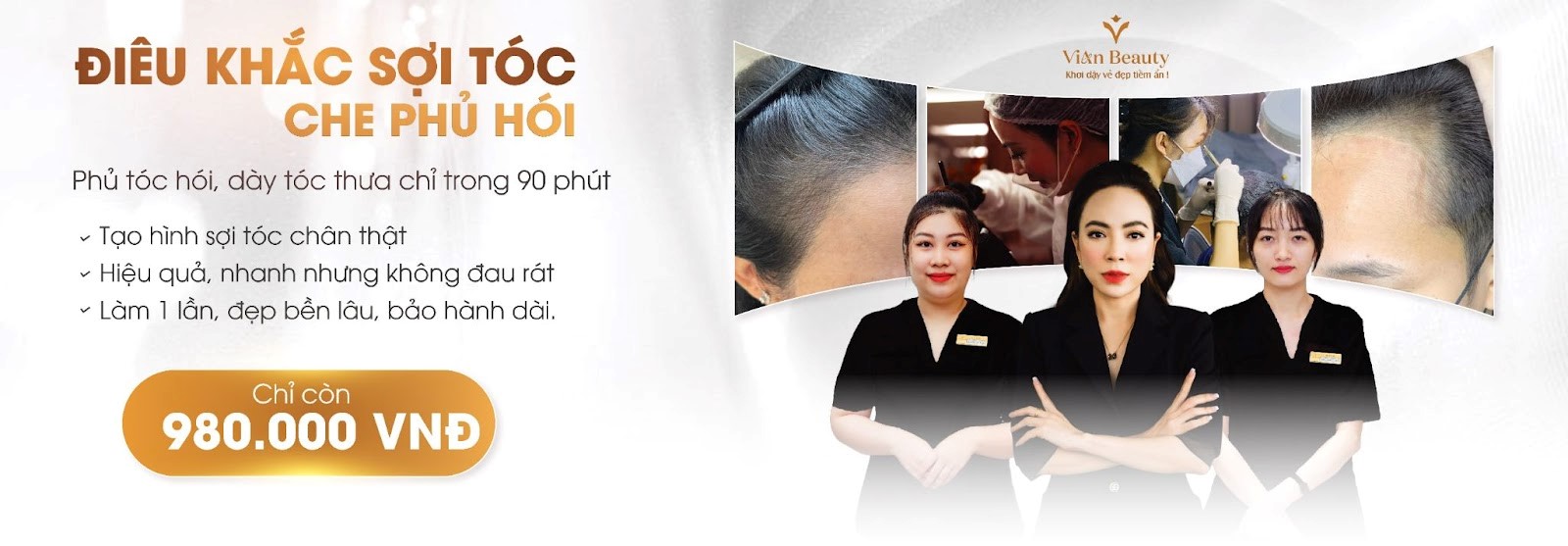 Che Phủ Tóc Thưa, Tóc Hói Cho Nam Nữ Bằng Điêu Khắc Sợi Tóc Tại Vian Beauty – Phương Pháp Không Xâm Lấn