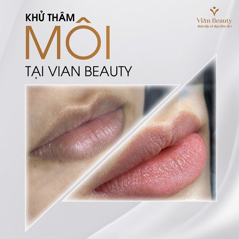 Khử Thâm Môi Nam