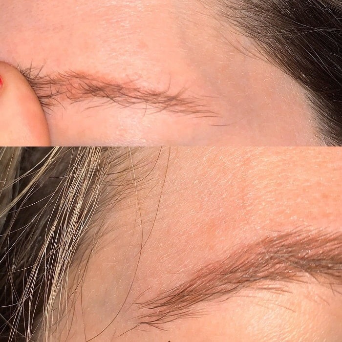 Rui Ro Khi Chon Dich Vu