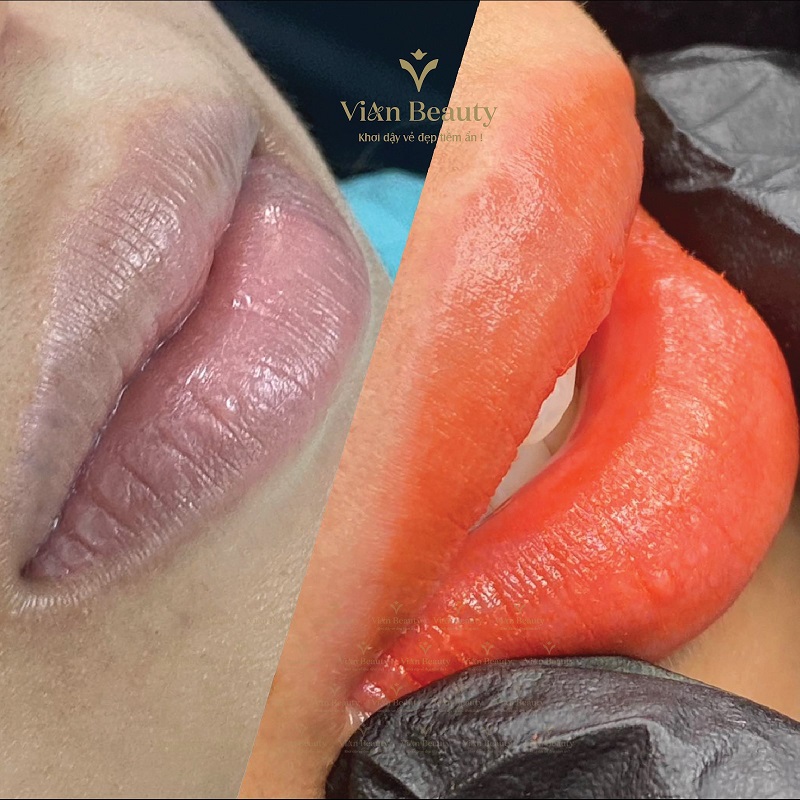 Vian Phun Moi Cho Nu