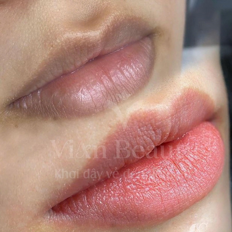 Ảnh Kết Quả Khách Hàng Sau Khi Sử Dụng Dịch Vụ Khử Thâm Môi Cho Nam Và Nữ Tại Vianbeauty