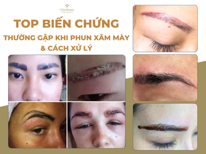 Top Các Biến Chứng Thường Gặp Khi Phun Xăm Mày