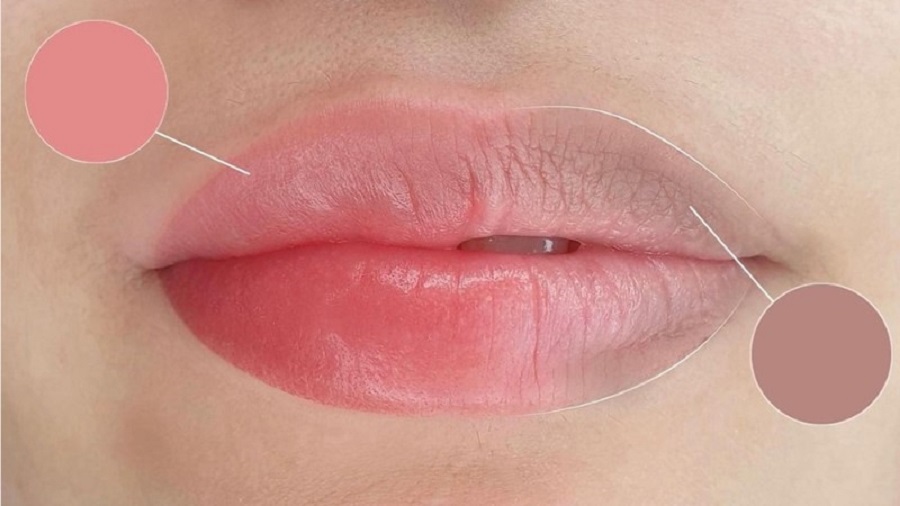 Chăm Sóc Môi Sau Khi Khử Thâm Môi Cho Nam Và Nữ