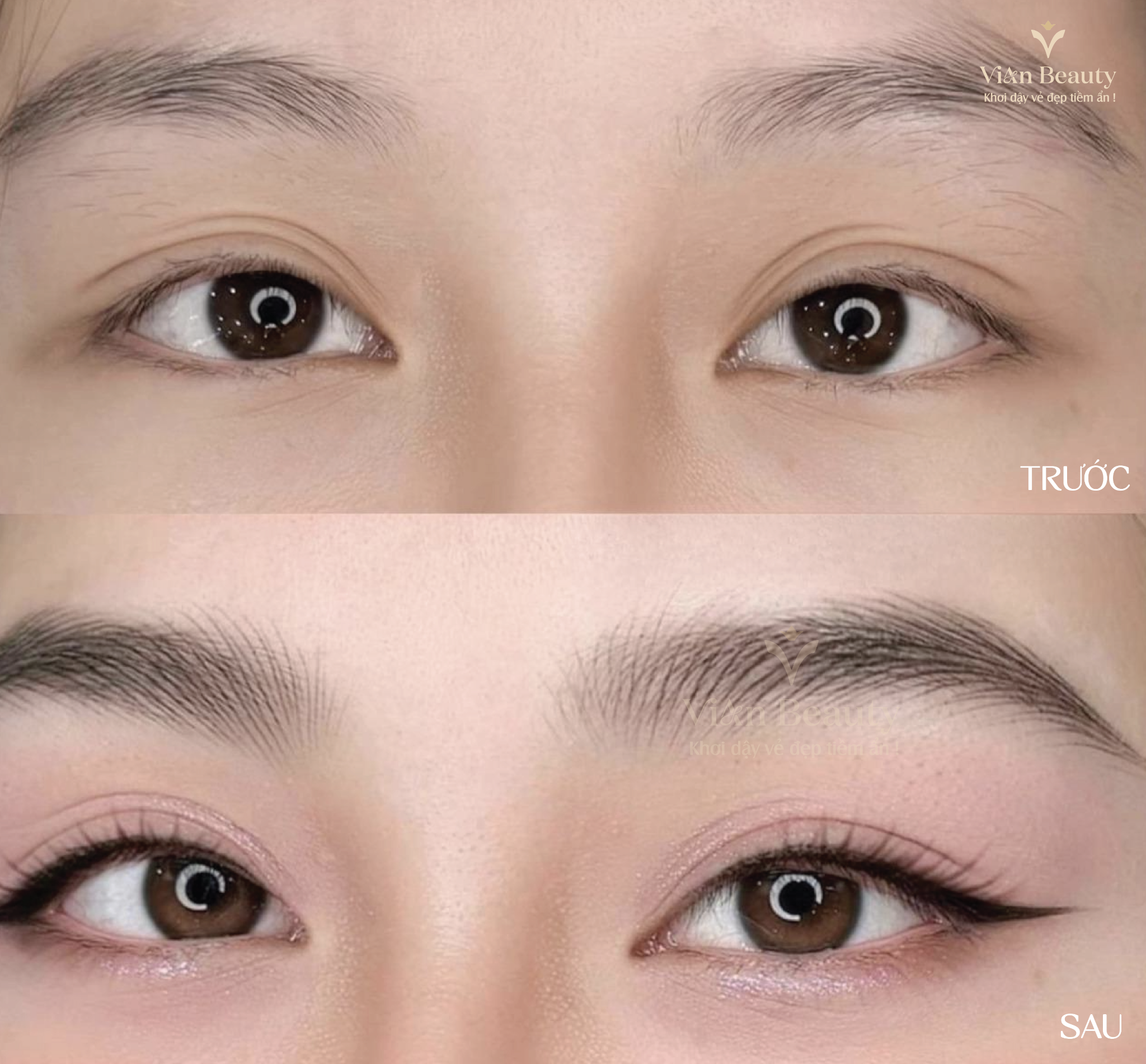 Ket Qua Truoc Sau Dieu Khac Chan May Tai Vian 6