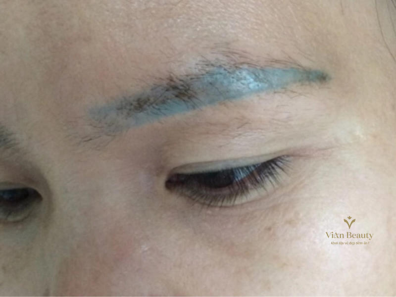 Các Biến Chứng Thường Gặp Khi Phun Xăm Mày