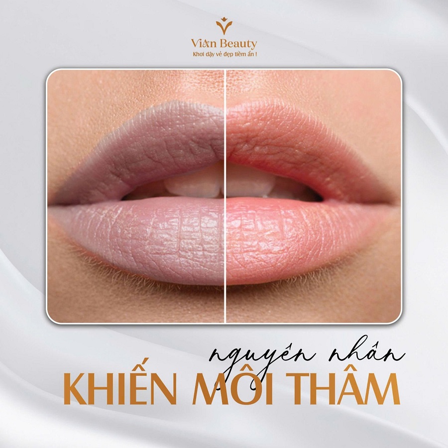 Nguyên Nhân Gây Môi Thâm