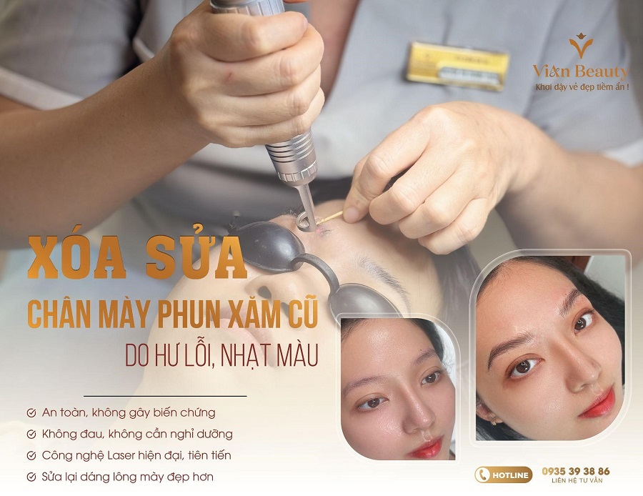 Xóa Sửa Chân Mày Phun Xăm Cũ Do Hư Lỗi, Nhạt Màu Tại Vian Beauty: Khôi Phục Vẻ Đẹp Tự Nhiên, An Toàn Tuyệt Đối - Chuyên Gia Giải Đáp Mọi Thắc Mắc