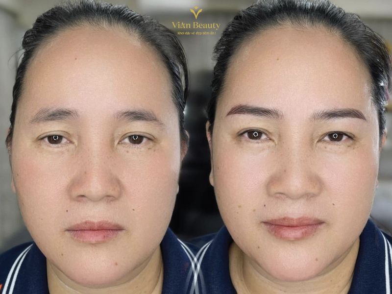 Làm Phong Thủy Khuôn Mặt Trước Và Sau