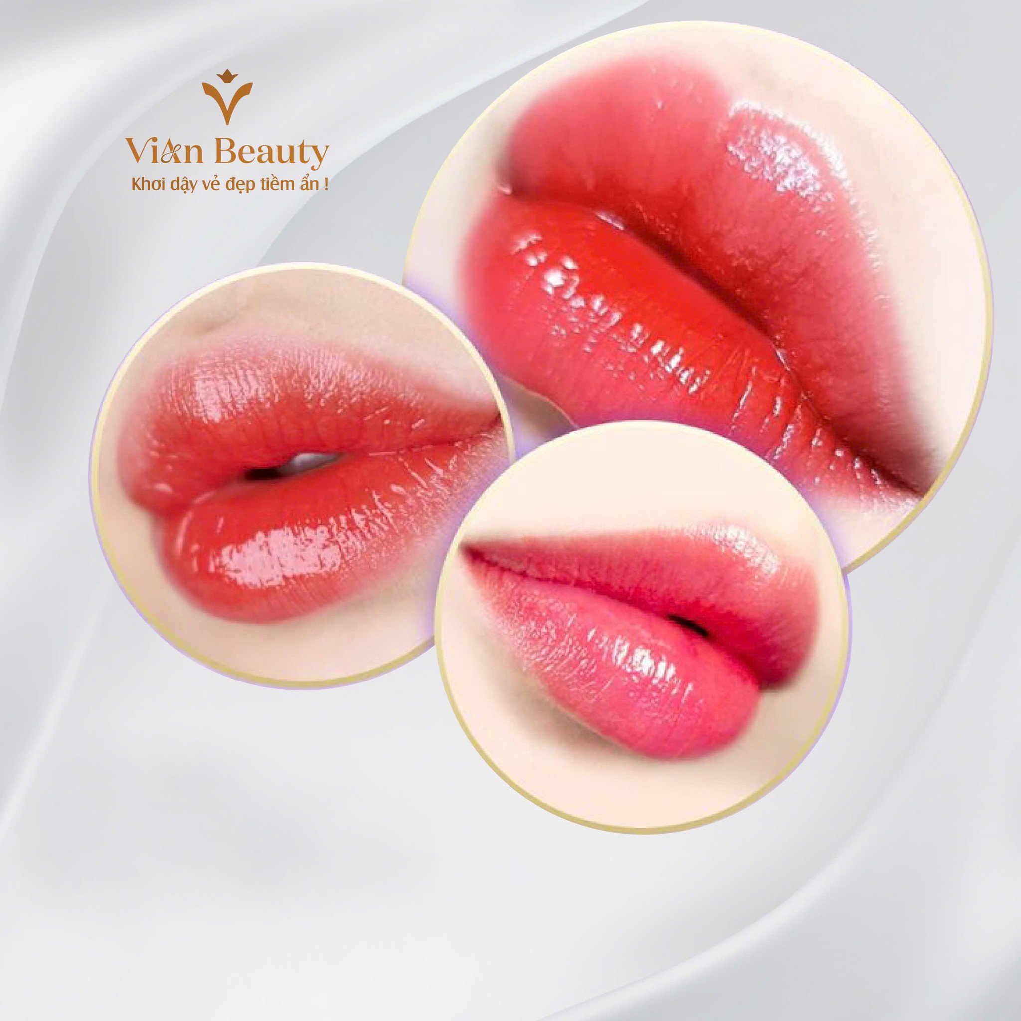 Dịch Vụ Hút Mực Môi Tại Vian Beauty