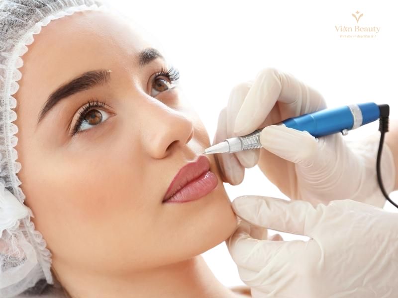 Liệu Trình Hút Mục Môi