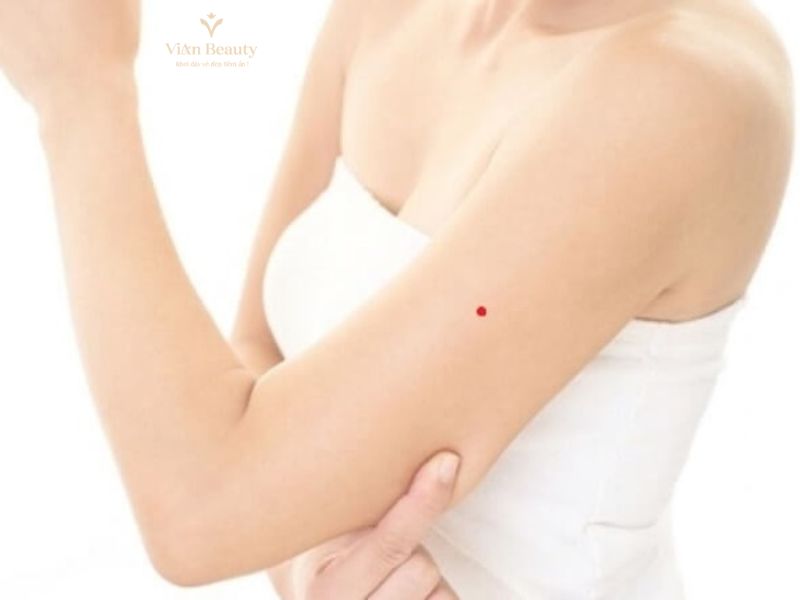 Nốt Ruồi Phong Thủy Ở Bắp Tay