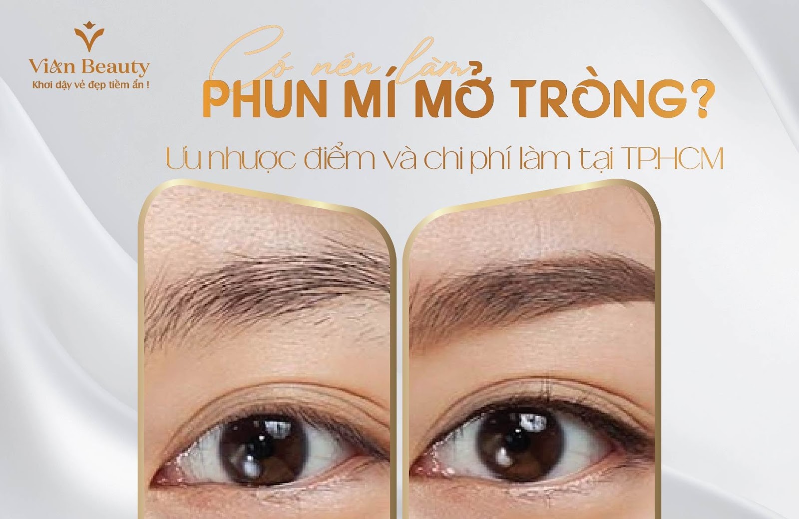 Dịch Vụ Phun Mí Mở Tròng Tại Hcm