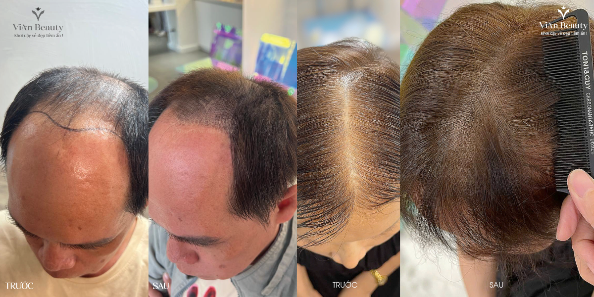 Dieu-Khac-Soi-Toc-Dinh-Dau