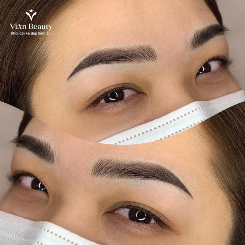 Phay Soi Dau Phun Duoi 05