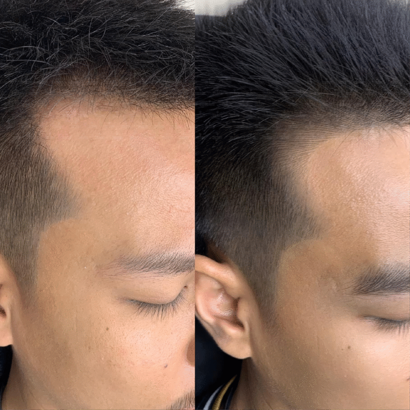 Che Hoi Hai Ben Toc Mai Bang Dieu Khac Toc Mai 3