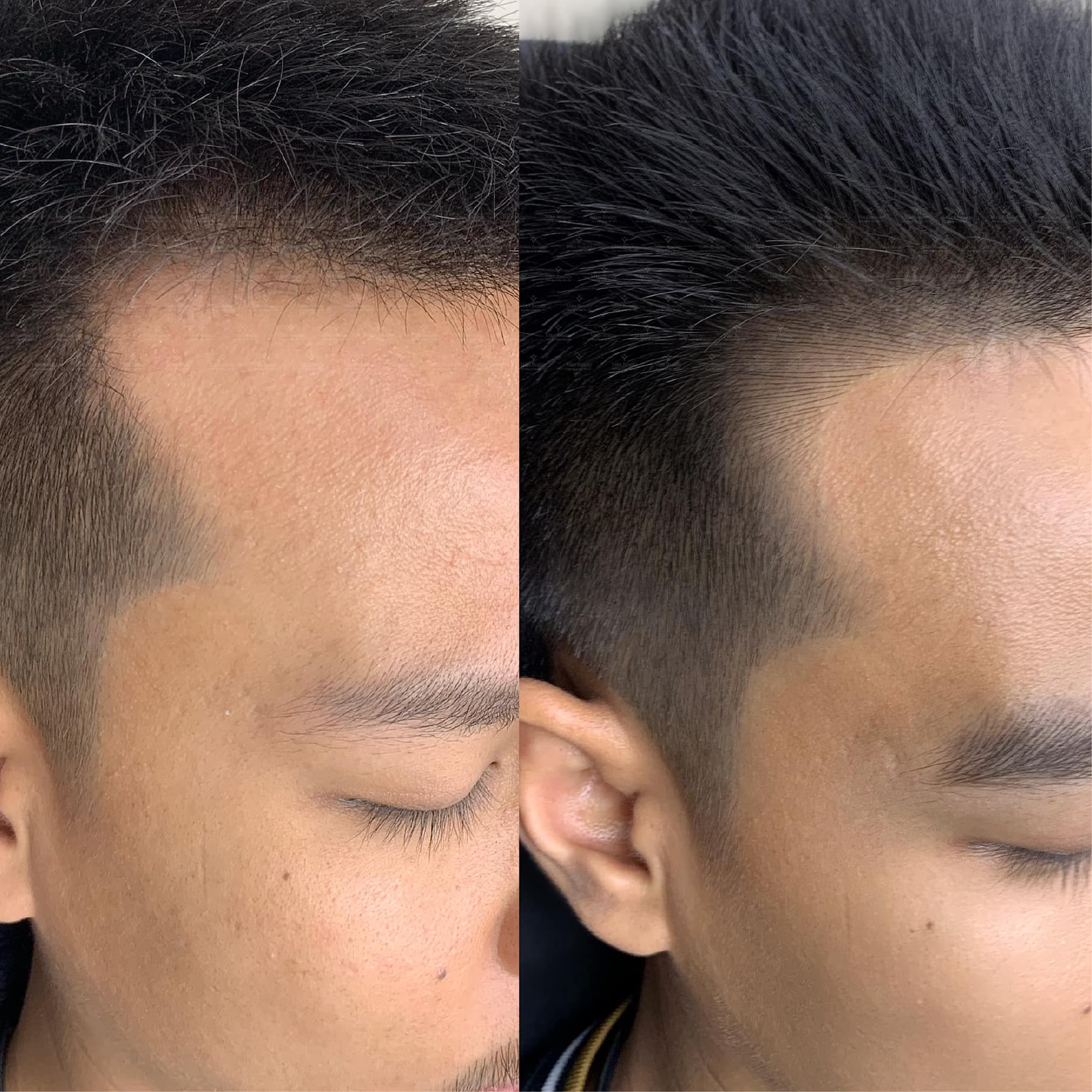 Che Hoi Hai Ben Toc Mai Bang Dieu Khac Toc Mai 3