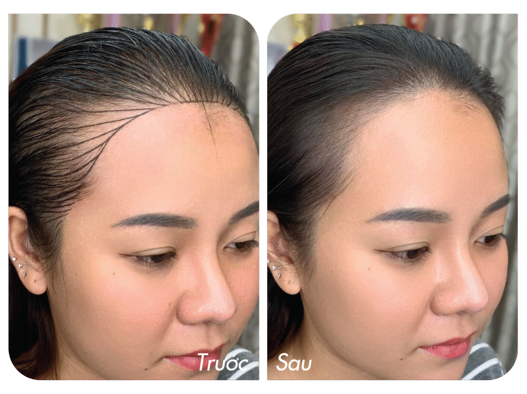 Che Hoi Hai Ben Toc Mai Bang Dieu Khac Toc Mai 4