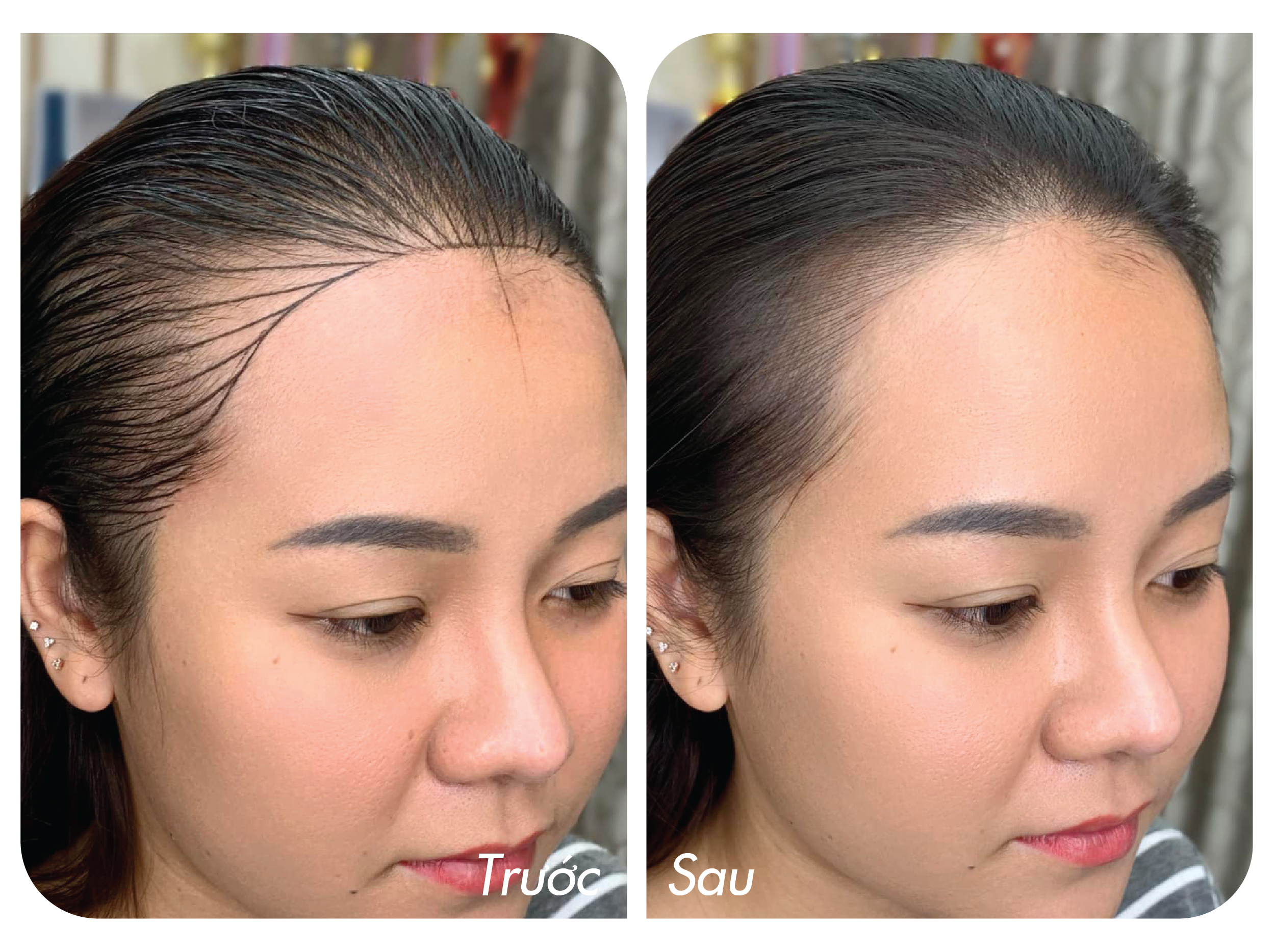 Che Hoi Hai Ben Toc Mai Bang Dieu Khac Toc Mai 4