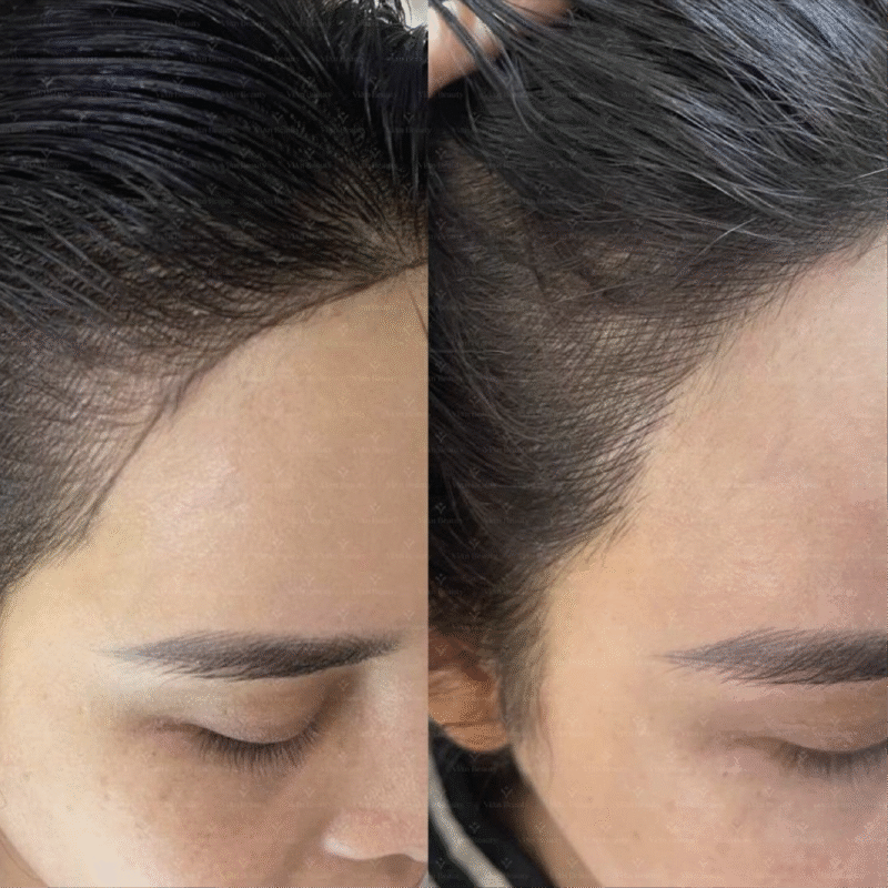 Điêu Khắc Tóc Có Đau Không