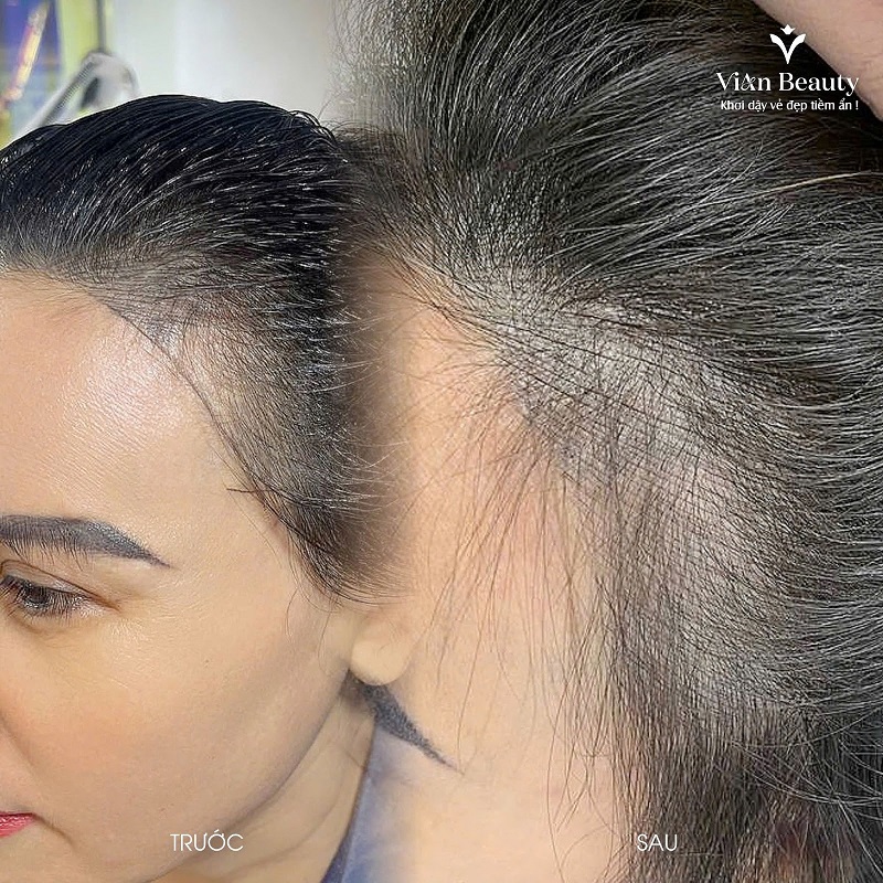 Hiệu Quả Điêu Khắc Tóc Rẻ Ngôi Tại Vian Beauty