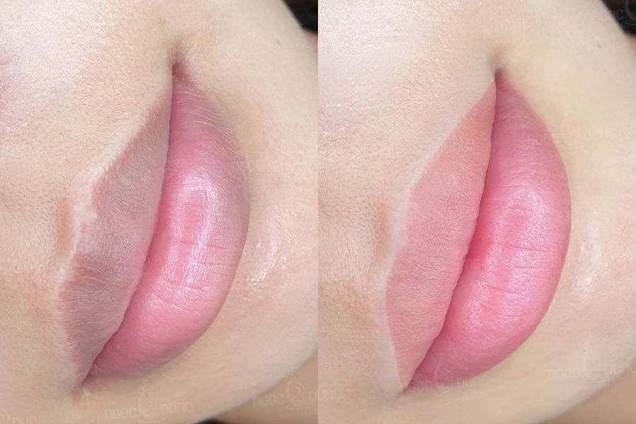 Khu Tham Moi Co Dau Khong Bao Lau Len Mau 2