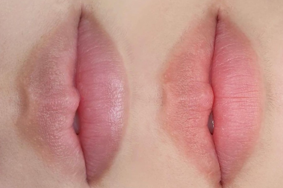 Khu Tham Moi Co Dau Khong Bao Lau Len Mau 3