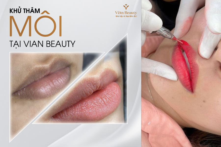 Khu Tham Moi Co Dau Khong Bao Lau Len Mau