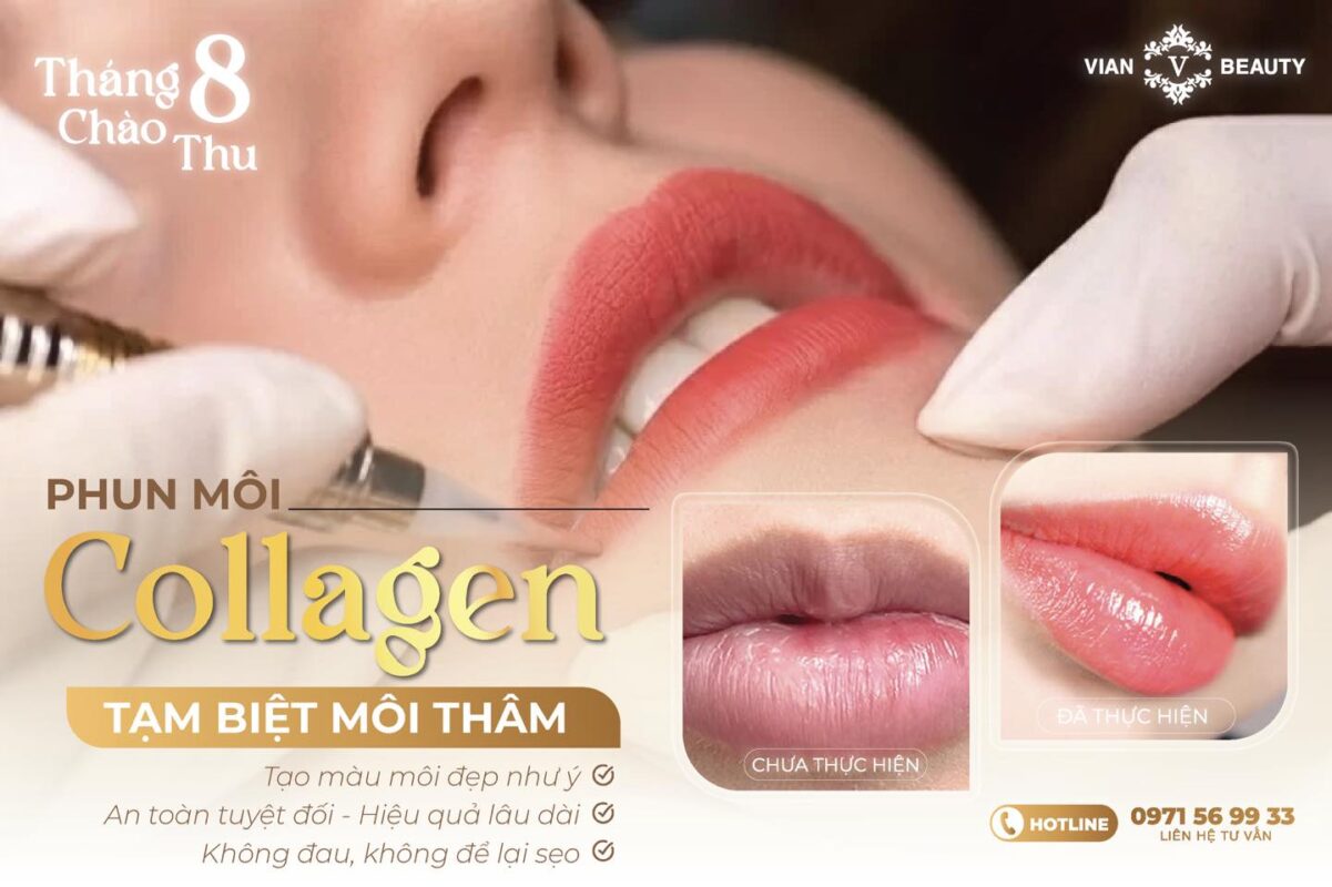 Phun Moi Collagen Len Mau Chuan Tai Vian Beauty Hcm 2 1