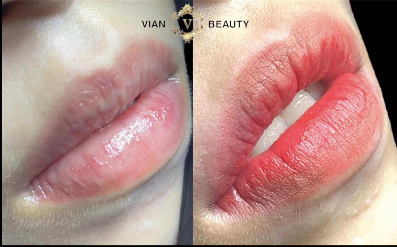 Phun Moi Ombre Cho Doi Moi Tu Nhien Tre Trung 3