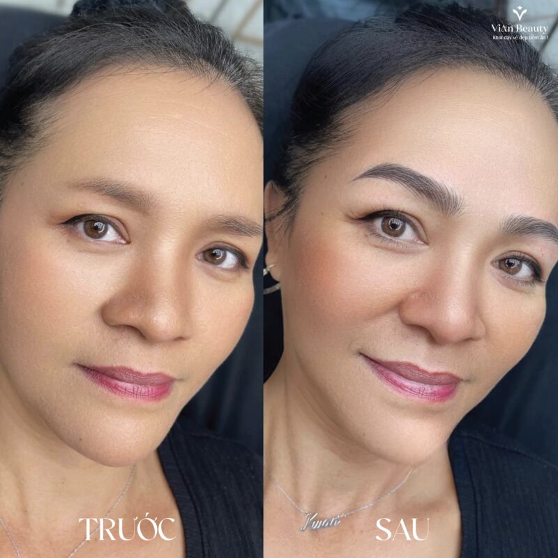 Co Nen Dam Lai Chan May Sau Phun Khong 1