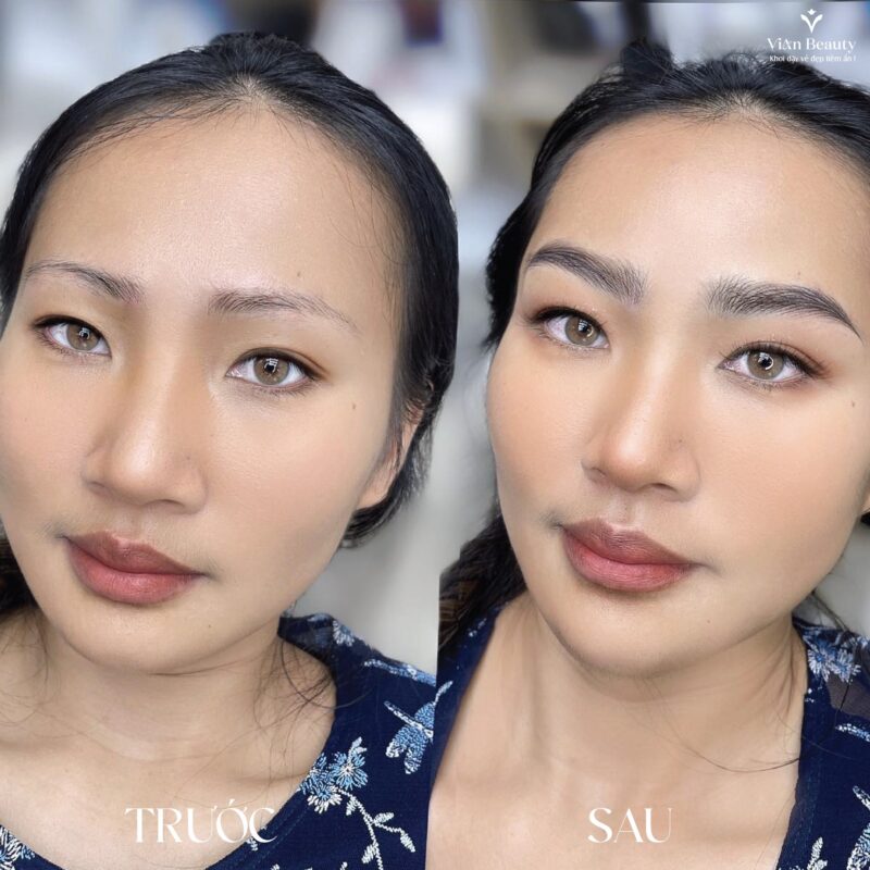 Co Nen Dam Lai Chan May Sau Phun Khong 3