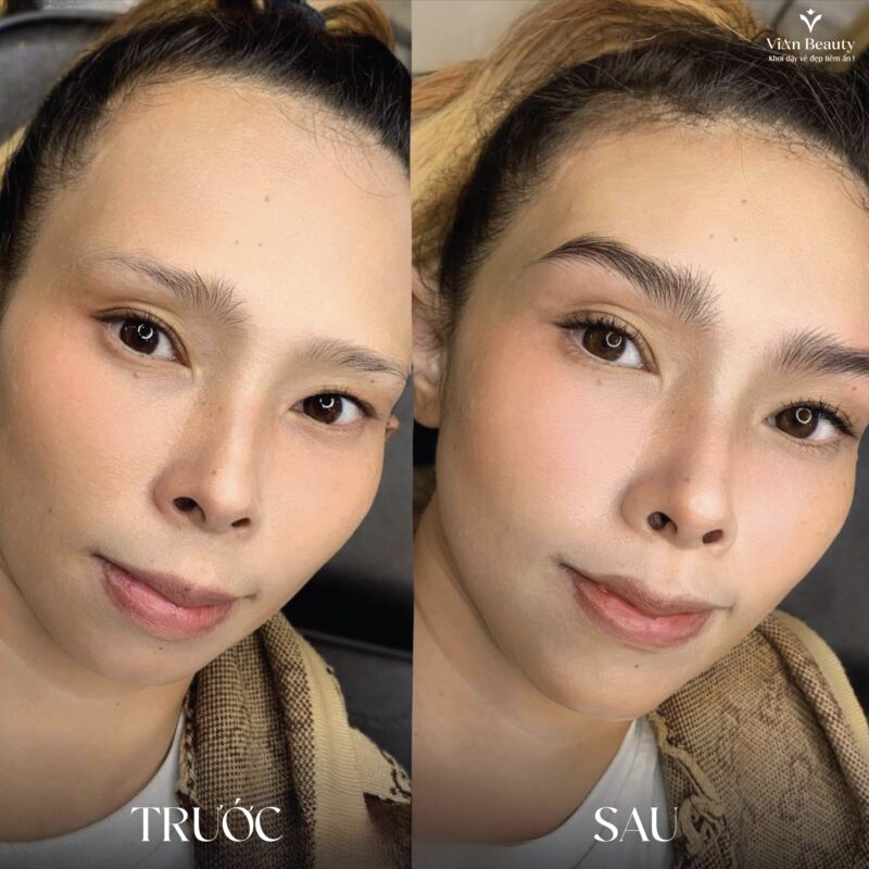 Co Nen Dam Lai Chan May Sau Phun Khong