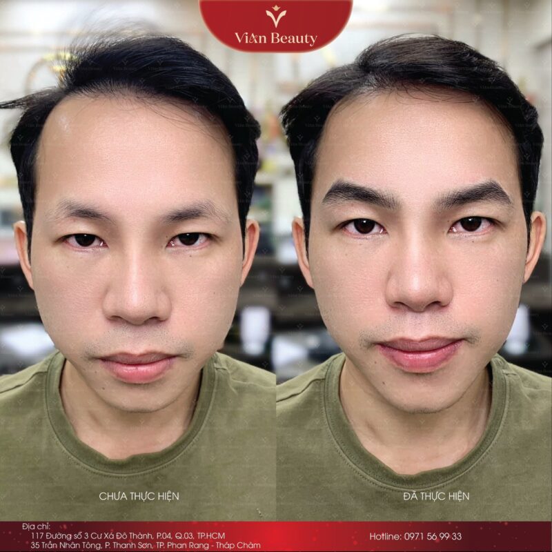 Phun May Nam Gioi Giai Phap Chan May Dam Nam Tinh 1