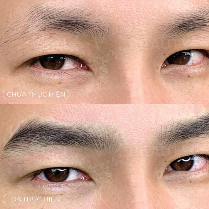 Phun May Nam Gioi Giai Phap Chan May Dam Nam Tinh 2