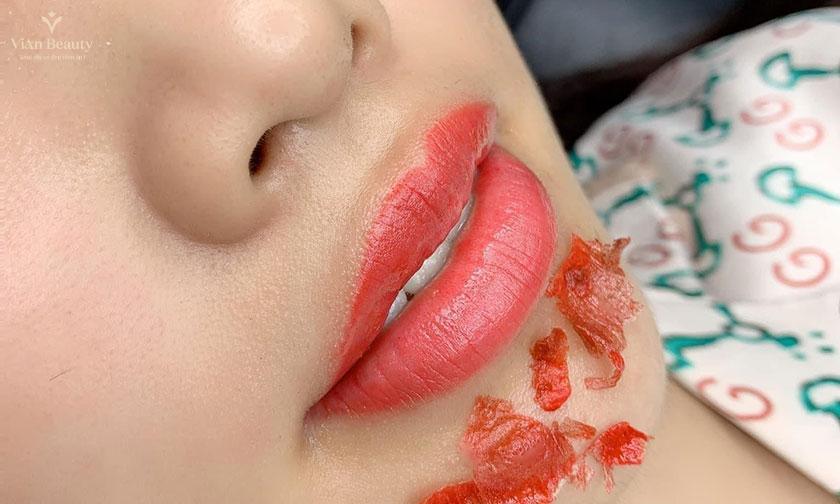 Phun Moi Bong Bao Lau 3