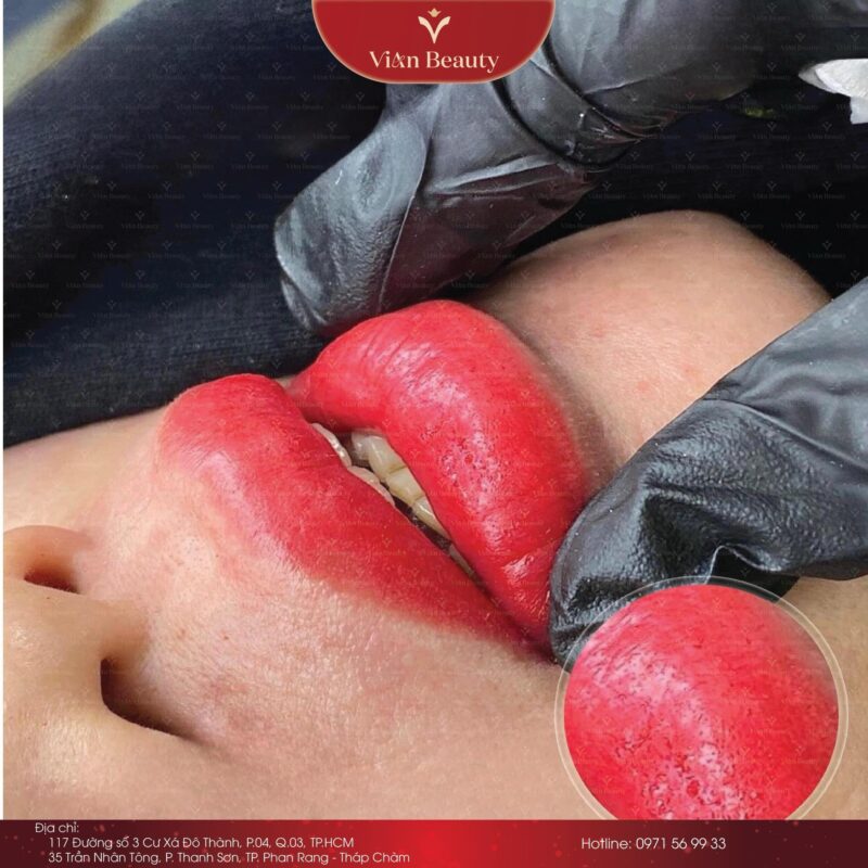 Phun Moi Bong Bao Lau 4