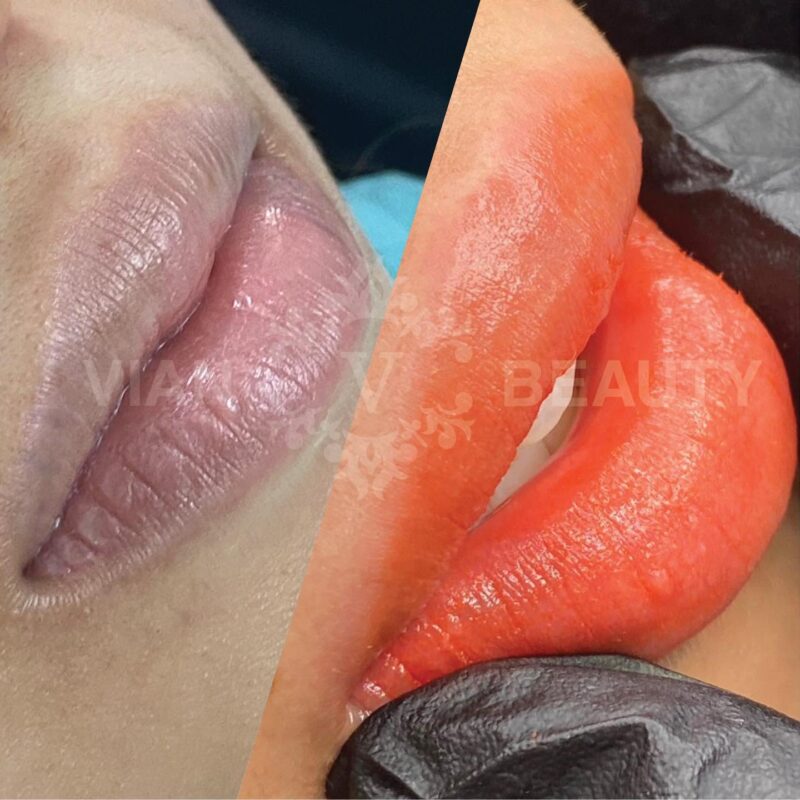 So Sanh Phun Moi Collagen Va Ombre Chi Tiet Nhat 3